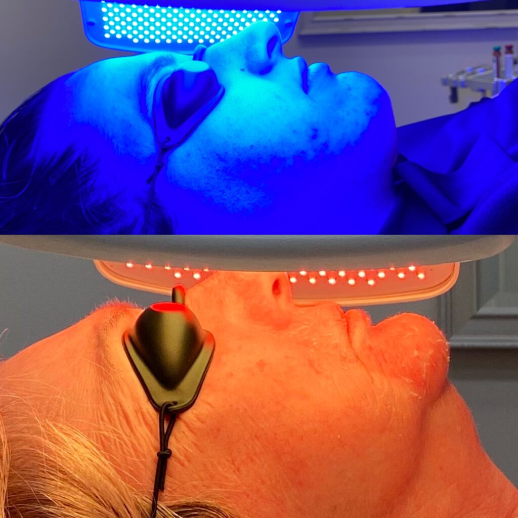 Laser Perfect - LED Therapy